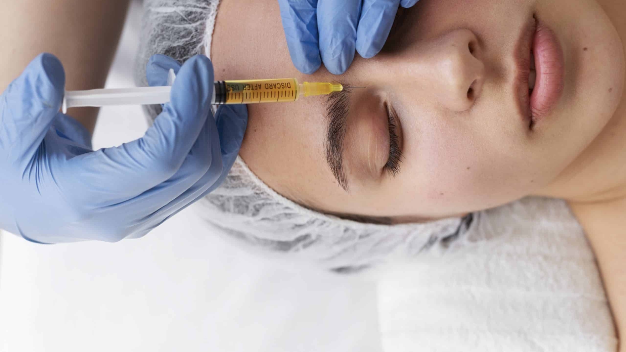 PRP Skin Rejuvenation