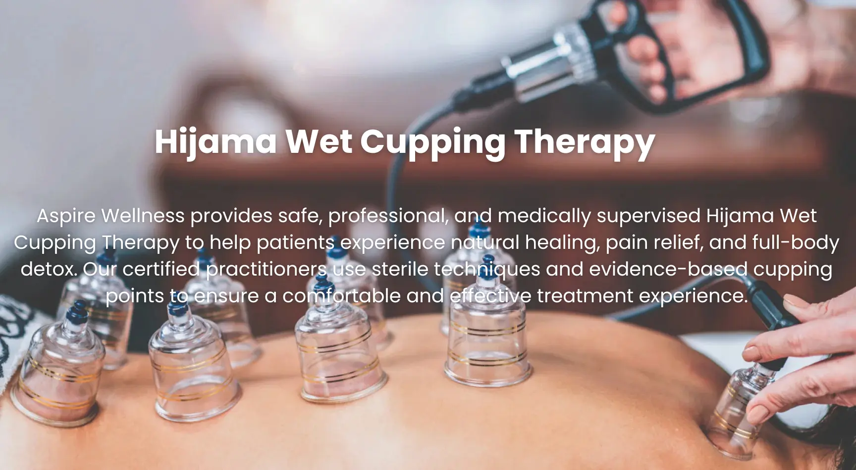 Hijama Wet Cupping Therapy