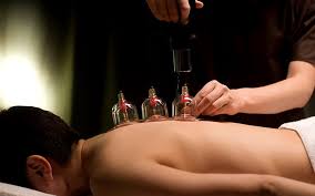 hijama cupping therapy