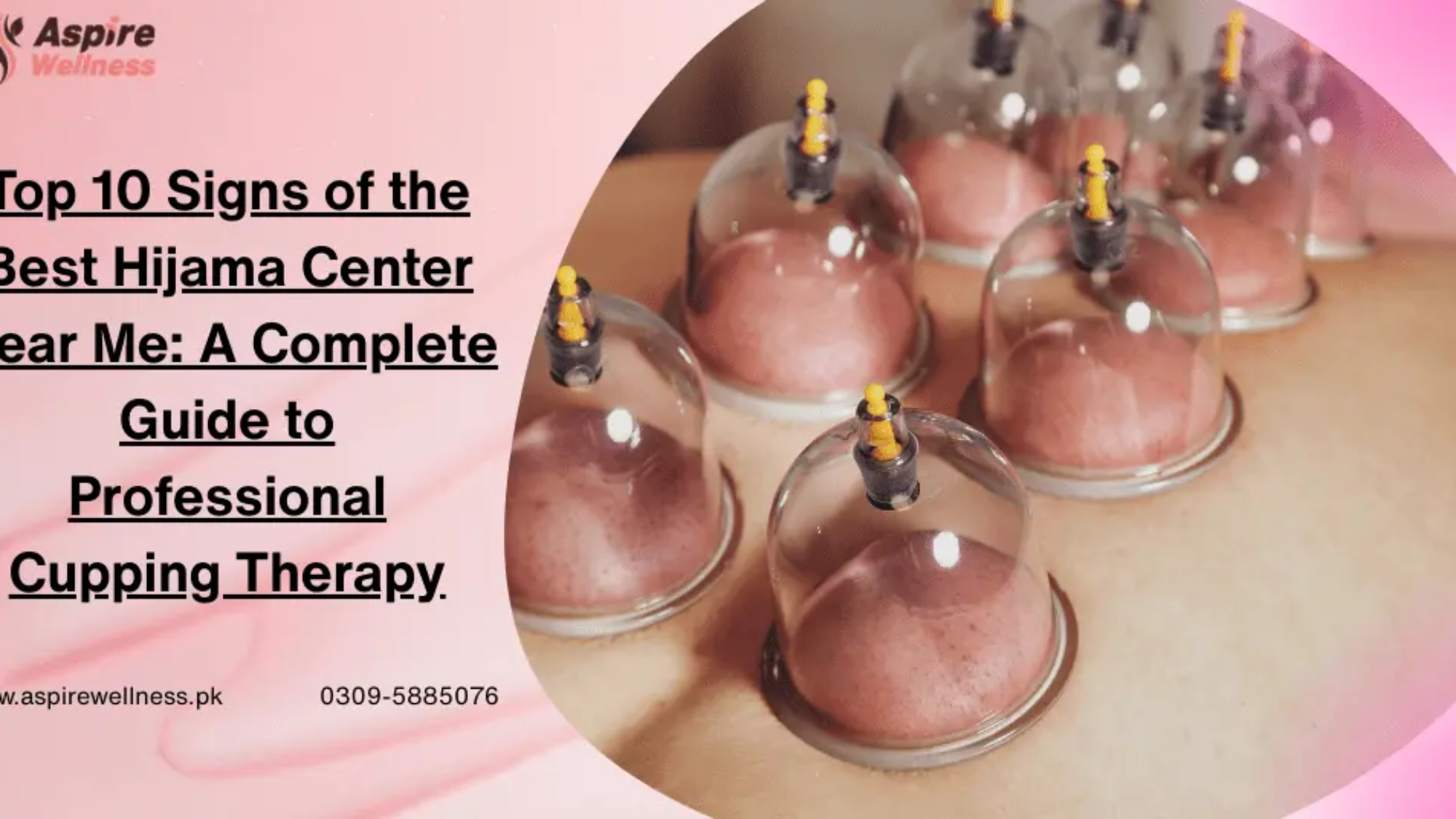 Cupping Therapy in DHA
